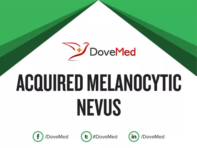 Acquired Melanocytic Nevus
