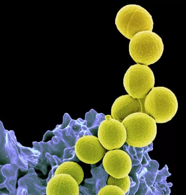 New Developments in Antibiotic Resistance