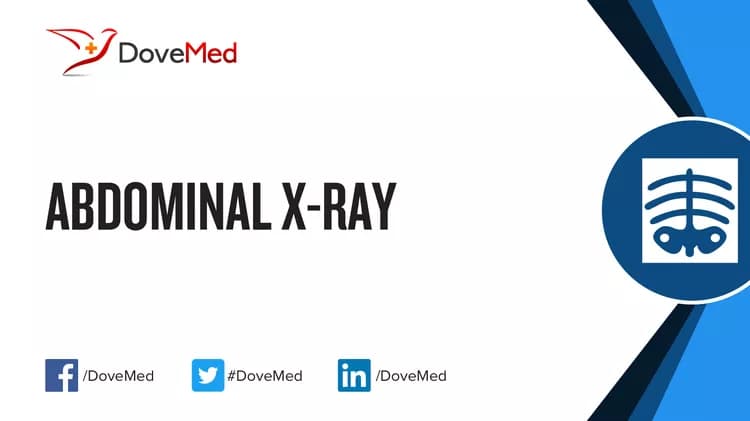 Abdominal X-ray