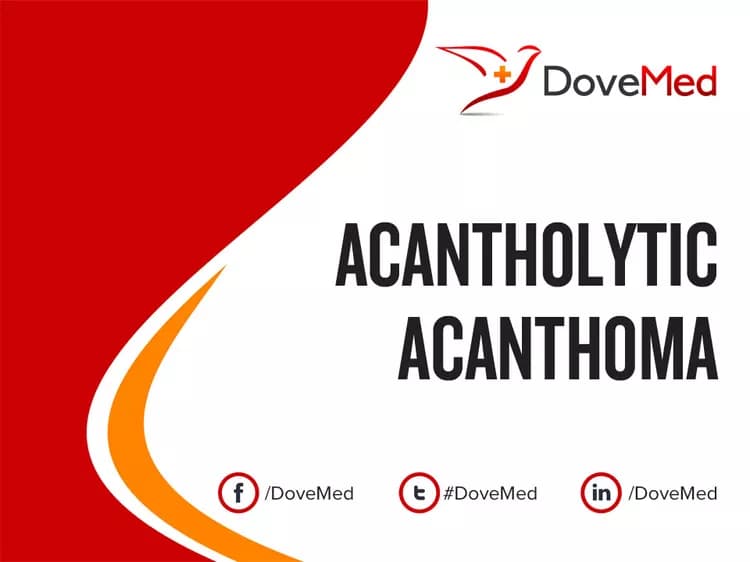 Acantholytic Acanthoma