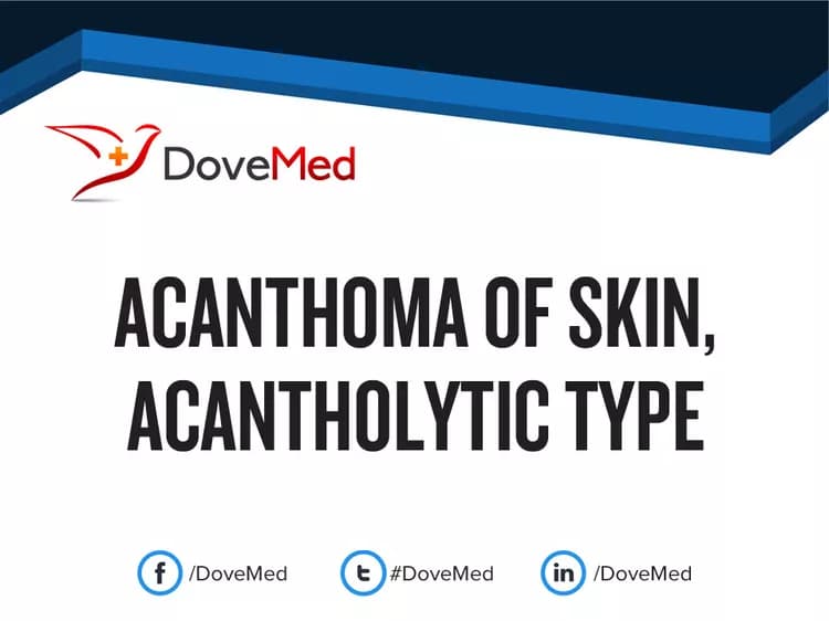 Acanthoma of Skin, Acantholytic Type