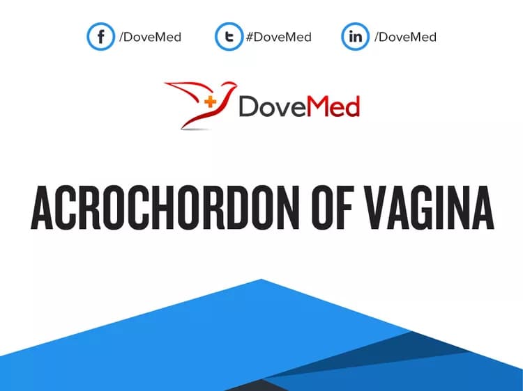 Acrochordon of Vagina