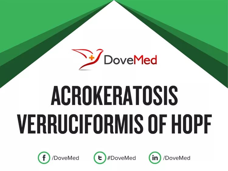 Acrokeratosis Verruciformis of Hopf