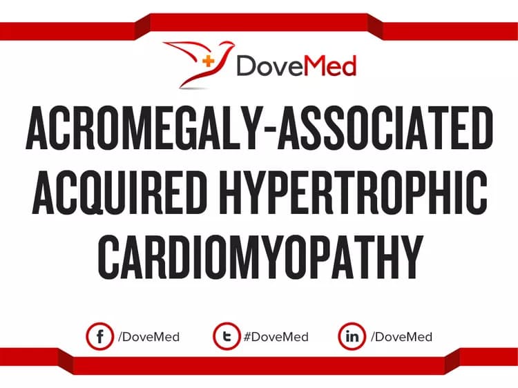 Acromegaly-Associated Acquired Hypertrophic Cardiomyopathy