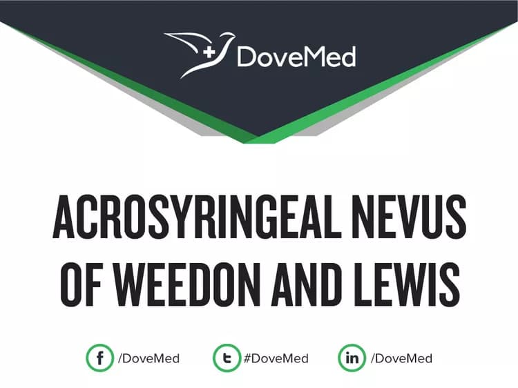 Acrosyringeal Nevus of Weedon and Lewis
