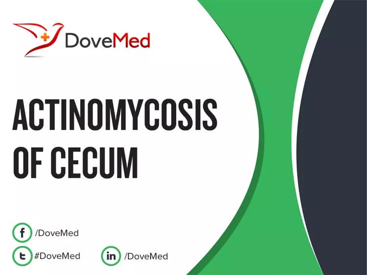 Actinomycosis of Cecum