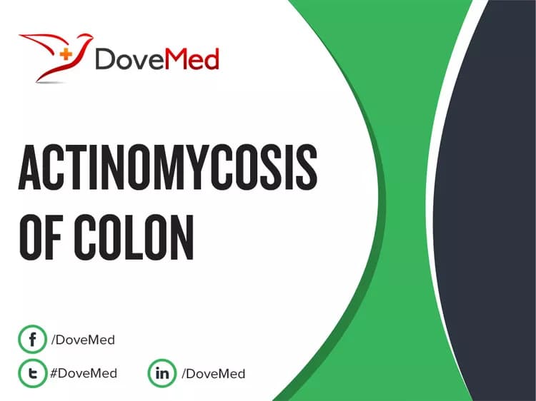 Actinomycosis of Colon