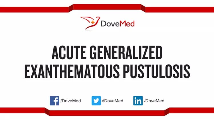 Acute Generalized Exanthematous Pustulosis