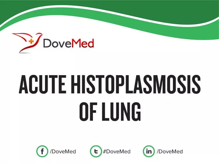 Acute Histoplasmosis of Lung