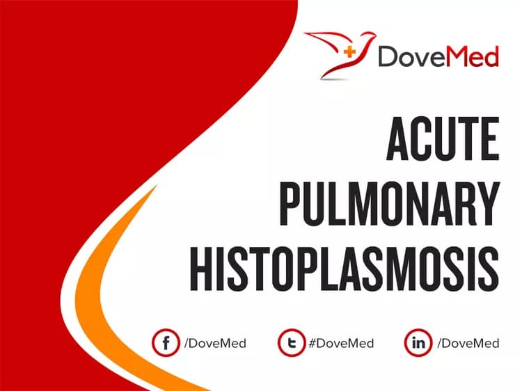 Acute Pulmonary Histoplasmosis