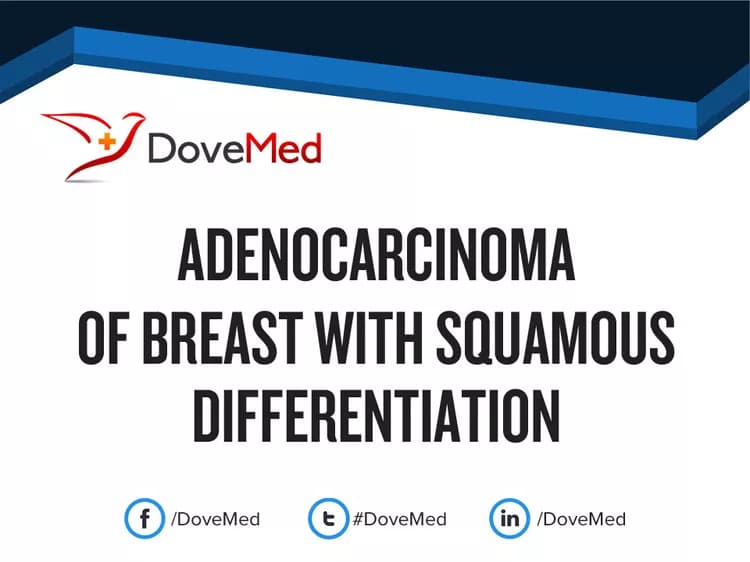 Adenocarcinoma of Breast with Squamous Differentiation