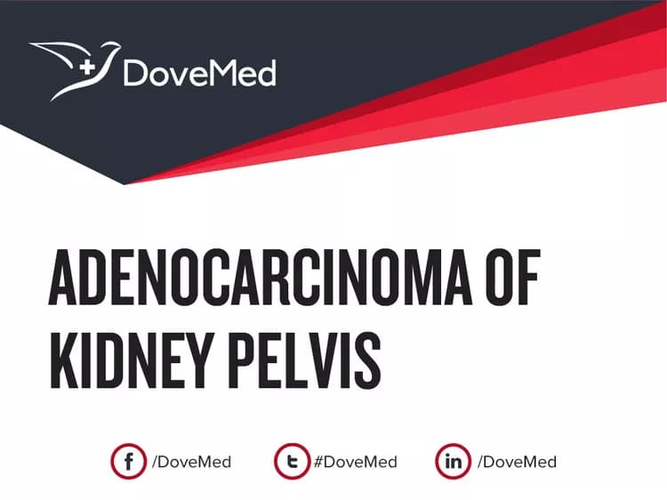 Adenocarcinoma of Kidney Pelvis