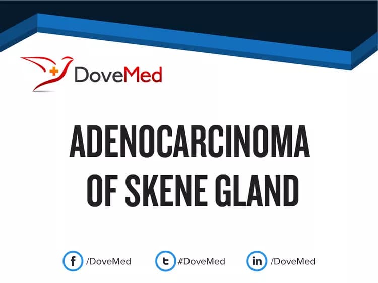 Adenocarcinoma of Skene Gland
