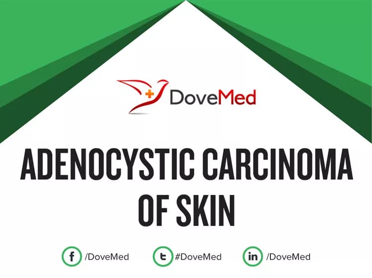 Adenocystic Carcinoma of Skin