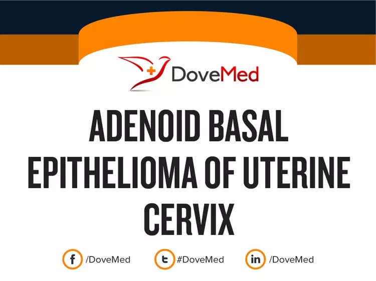 Adenoid Basal Epithelioma of Uterine Cervix