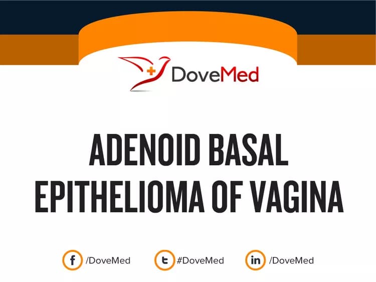 Adenoid Basal Epithelioma of Vagina