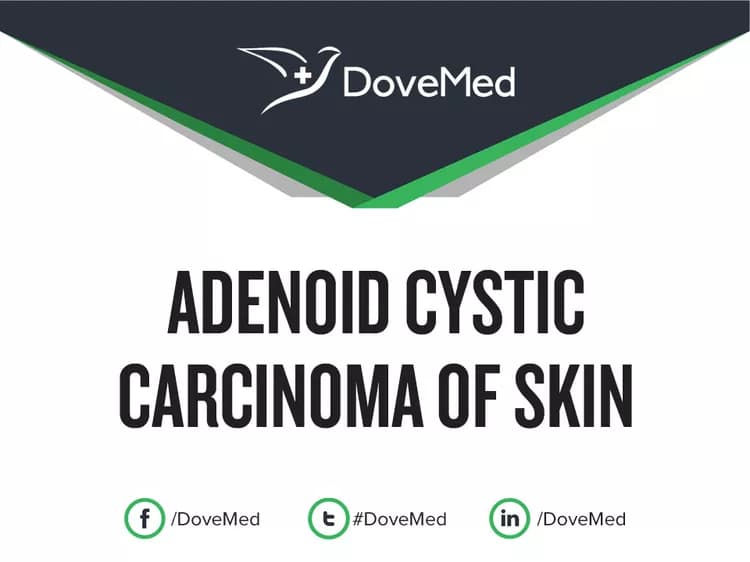 Adenoid Cystic Carcinoma of Skin
