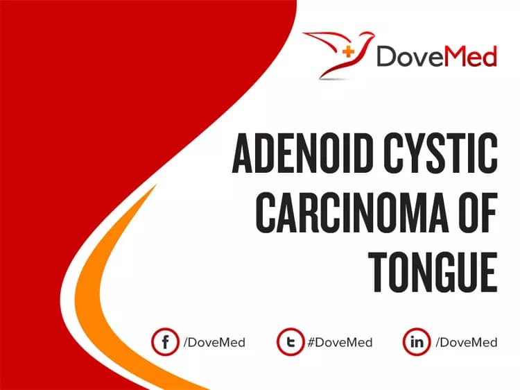 Adenoid Cystic Carcinoma of Tongue