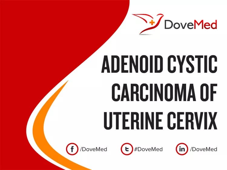Adenoid Cystic Carcinoma of Uterine Cervix