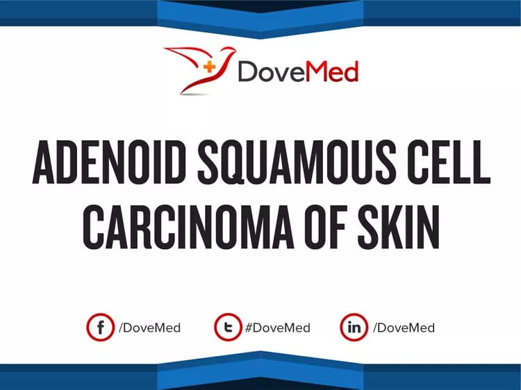 Adenoid Squamous Cell Carcinoma of Skin