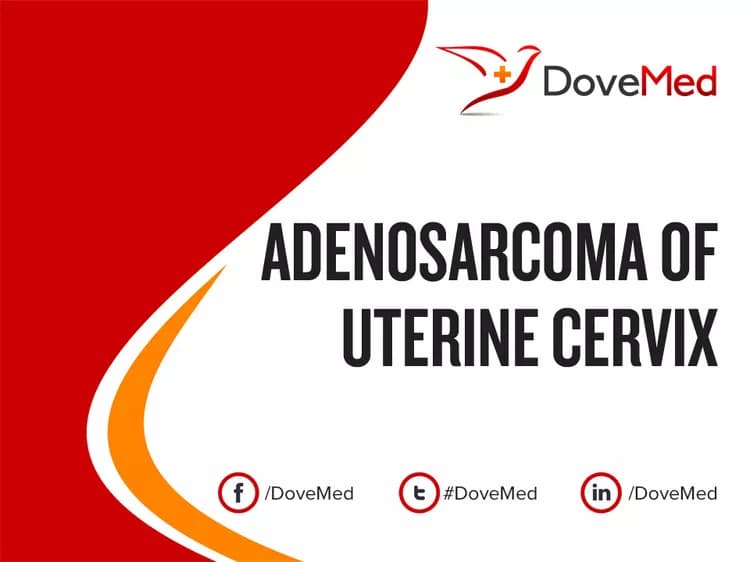 Adenosarcoma of Uterine Cervix