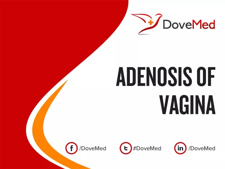 Adenosis of Vagina