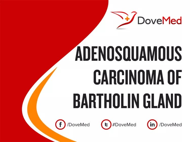 Adenosquamous Carcinoma of Bartholin Gland