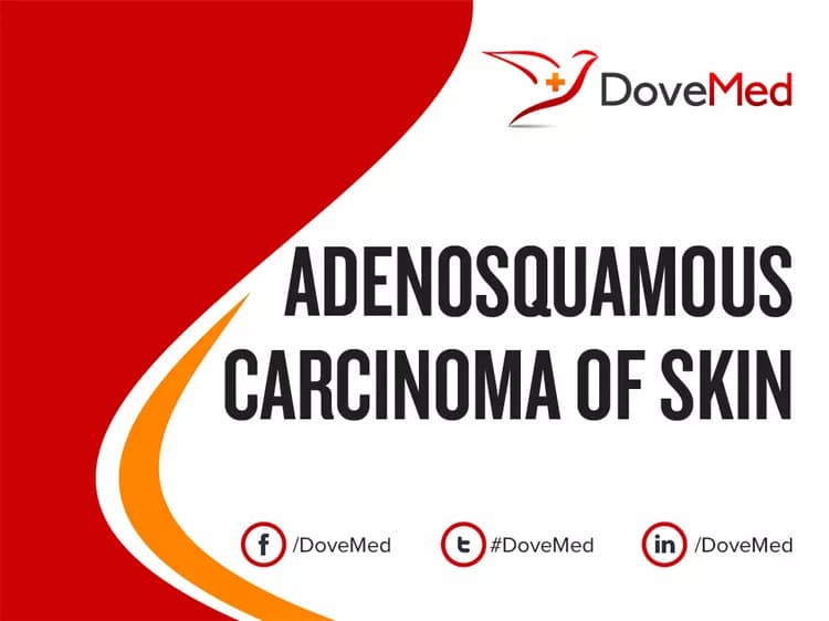 Adenosquamous Carcinoma of Skin