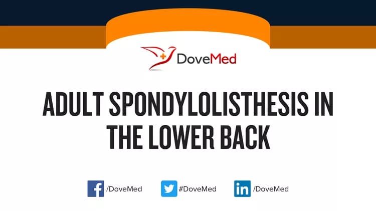 How well do you know Adult Spondylolisthesis in the Lower Back