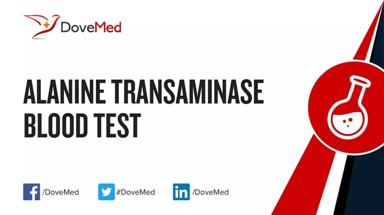 Alanine Transaminase Blood Test