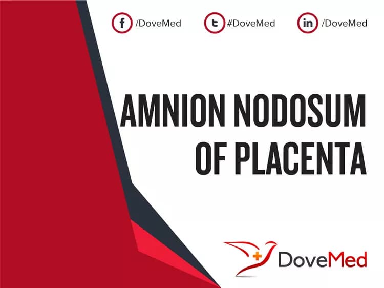 Amnion Nodosum of Placenta
