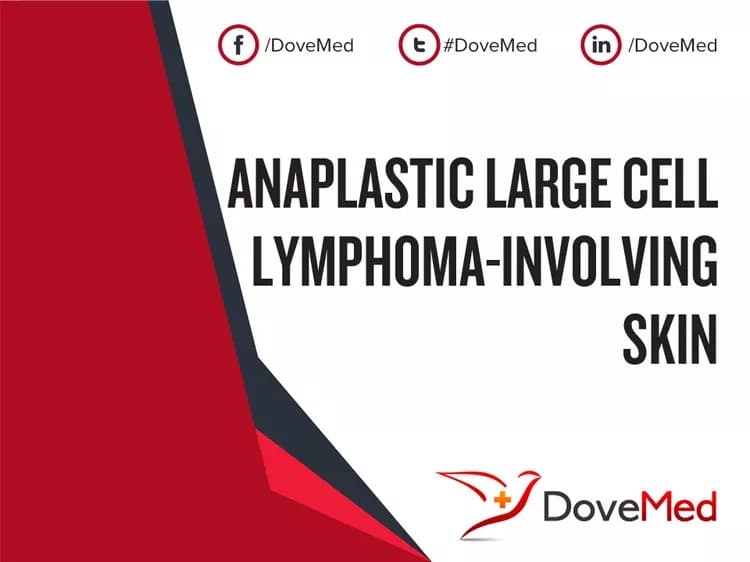 Anaplastic Large Cell Lymphoma-involving Skin