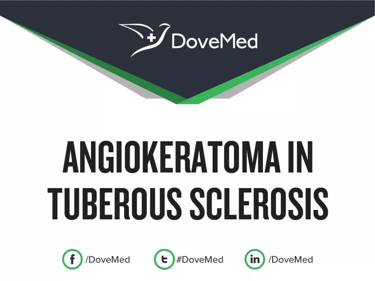 Angiokeratoma in Tuberous Sclerosis