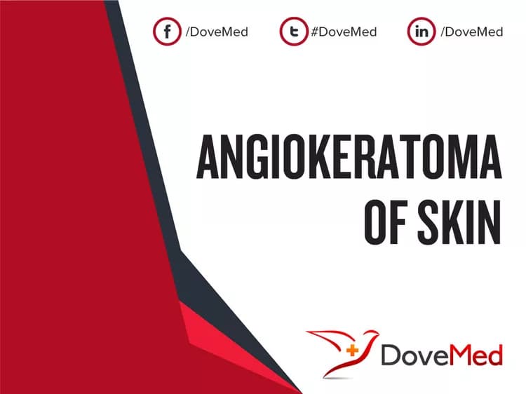 Angiokeratoma of Skin