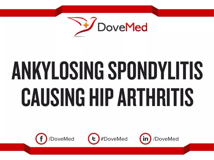 Ankylosing Spondylitis causing Hip Arthritis