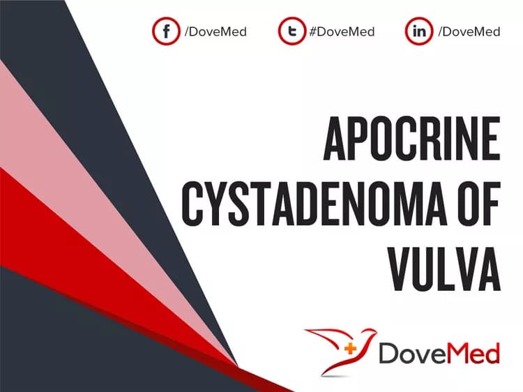 Apocrine Cystadenoma of Vulva
