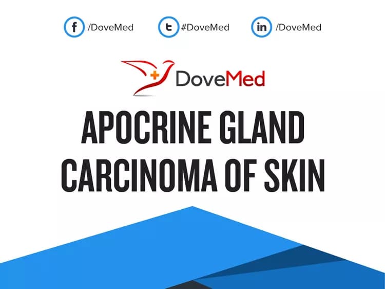 Apocrine Gland Carcinoma of Skin