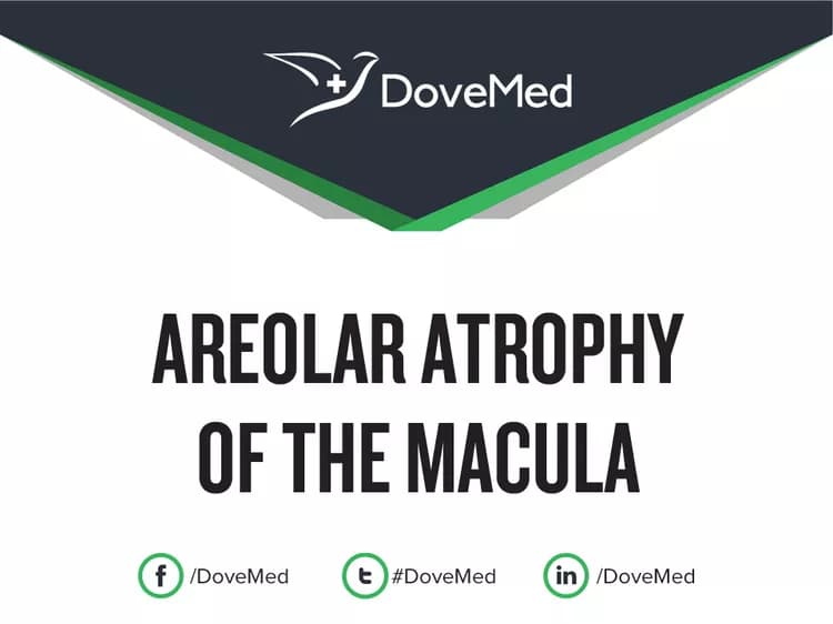 Areolar Atrophy of the Macula