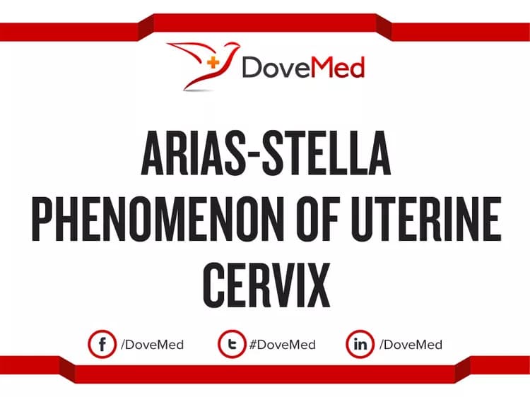 Arias-Stella Phenomenon of Uterine Corpus