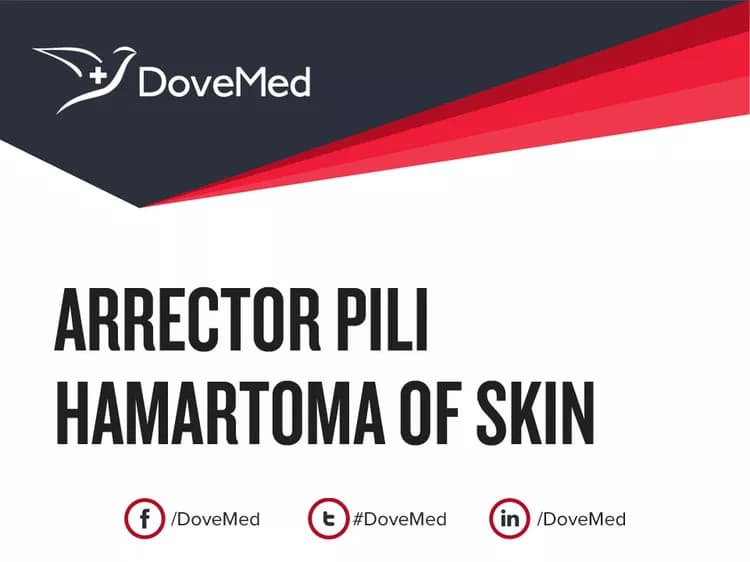 Arrector Pili Hamartoma of Skin