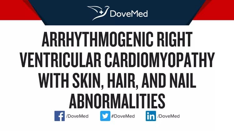 Arrhythmogenic Right Ventricular Dysplasia/Cardiomyopathy (ARVD/C)