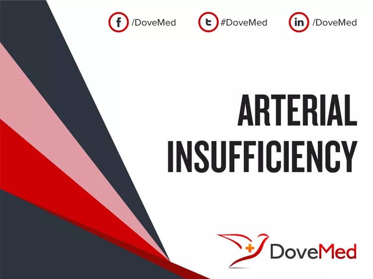 How well do you know Arterial Insufficiency?