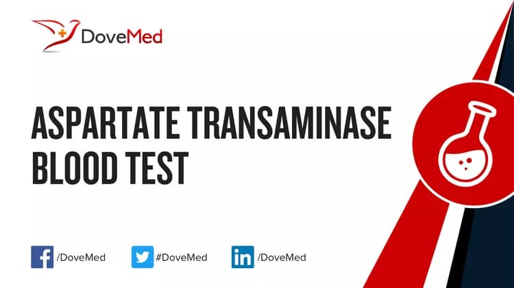 Aspartate Transaminase Blood Test