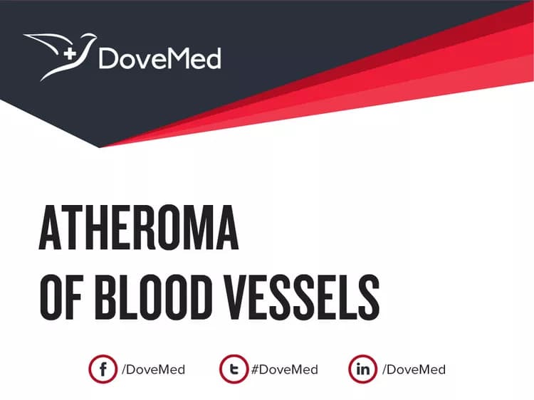 Atheroma of Blood Vessels