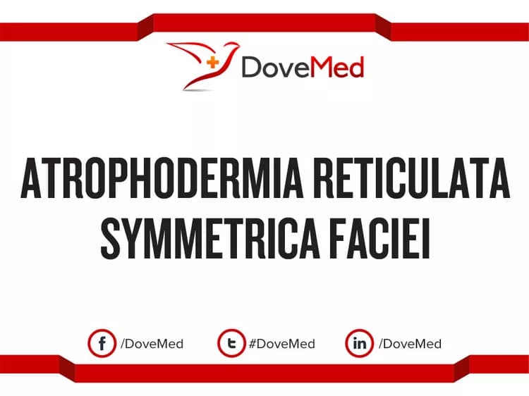 Atrophodermia Reticulata Symmetrica Faciei