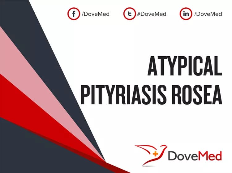 Atypical Pityriasis Rosea