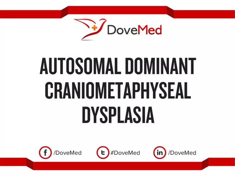 Autosomal Dominant Craniometaphyseal Dysplasia