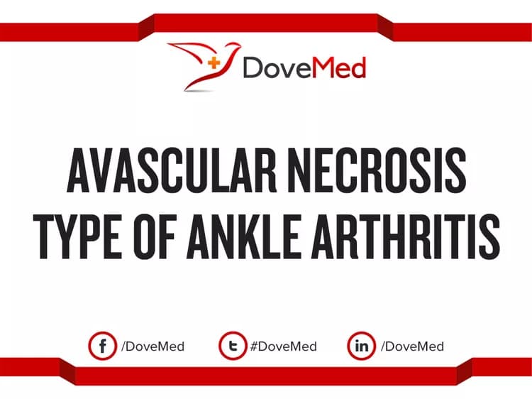 Avascular Necrosis type of Ankle Arthritis
