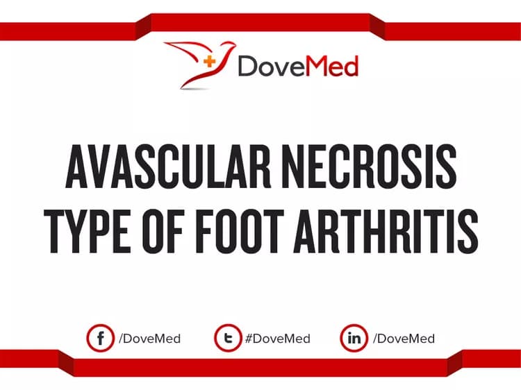 Avascular Necrosis type of Foot Arthritis