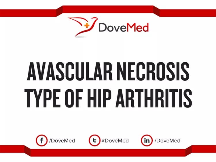 Avascular Necrosis type of Hip Arthritis